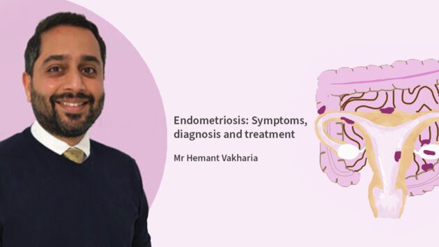 Endometriosis: symptoms, diagnosis and treatment