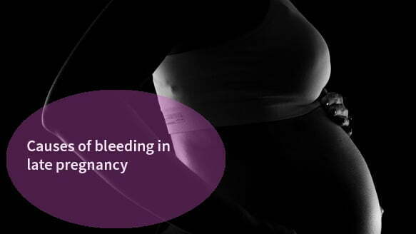 Ms Michelle Swer talks bleeding in late pregnancy